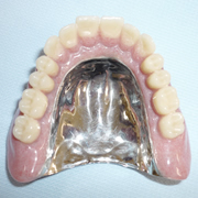 チタン総義歯